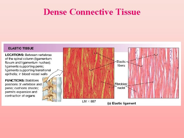 Dense Connective Tissue 