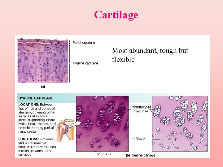 Cartilage Most abundant, tough but flexible 