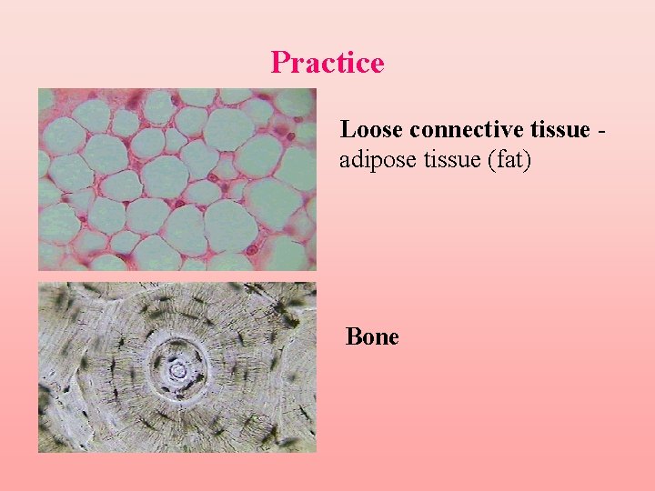 Practice Loose connective tissue adipose tissue (fat) Bone 