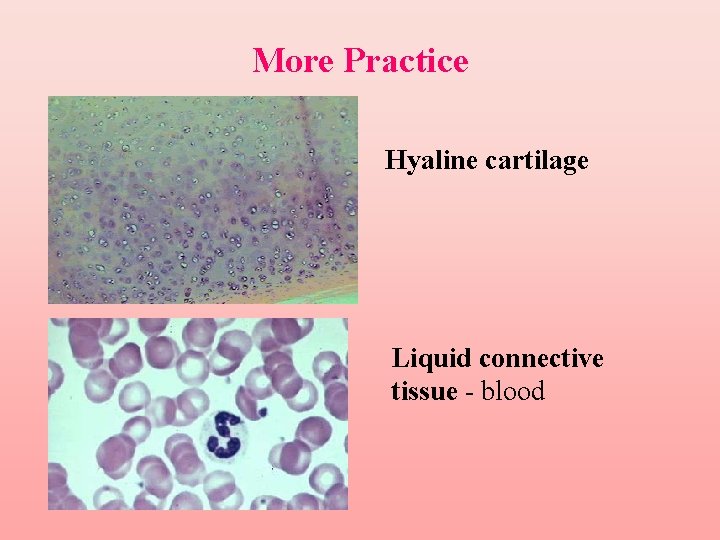 More Practice Hyaline cartilage Liquid connective tissue - blood 