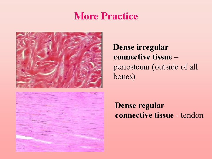 More Practice Dense irregular connective tissue – periosteum (outside of all bones) Dense regular