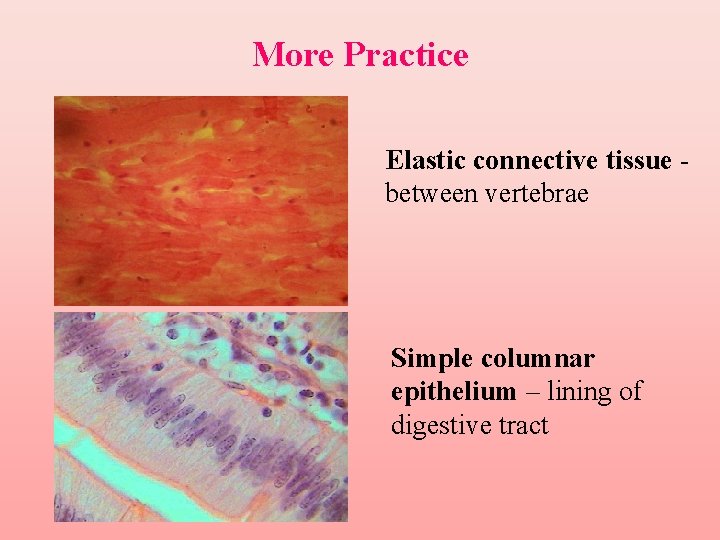 More Practice Elastic connective tissue between vertebrae Simple columnar epithelium – lining of digestive