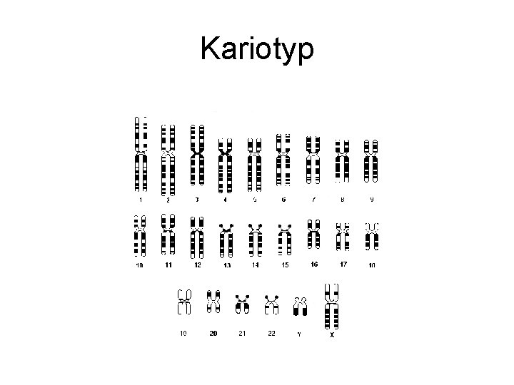 Kariotyp 