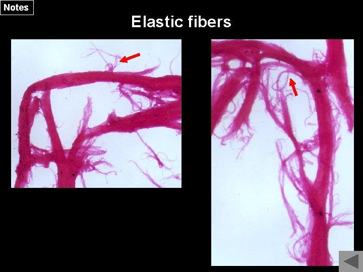 Notes Elastic fibers 