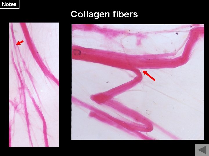 Notes Collagen fibers 
