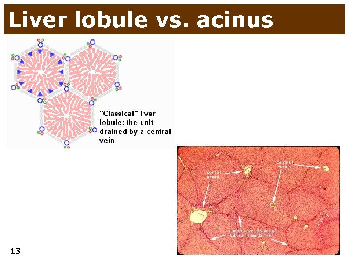Liver lobule vs. acinus 13 Liver lobule vs. acinus 13