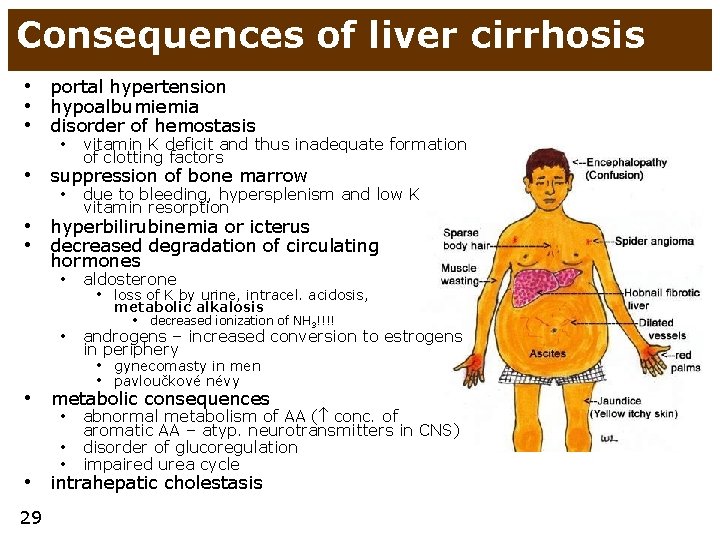 Consequences of liver cirrhosis • portal hypertension • hypoalbumiemia • disorder of hemostasis •