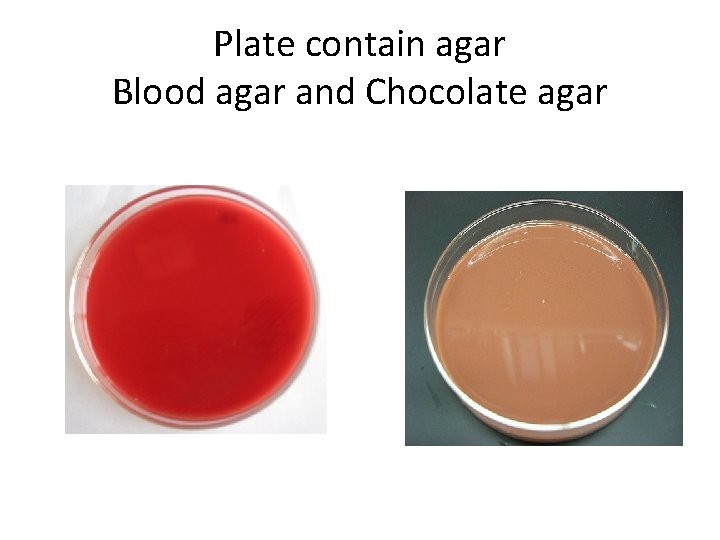 Plate contain agar Blood agar and Chocolate agar 