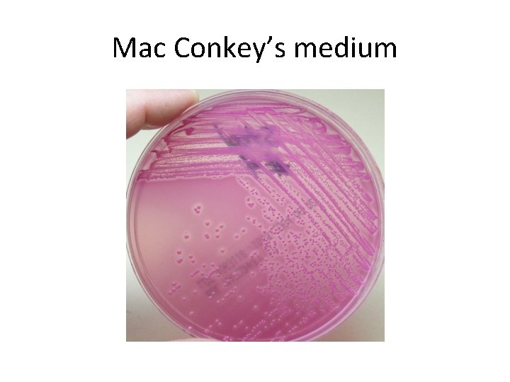 Mac Conkey’s medium 