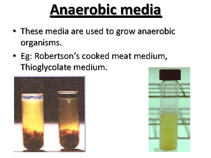 Anaerobic media • These media are used to grow anaerobic organisms. • Eg: Robertson’s