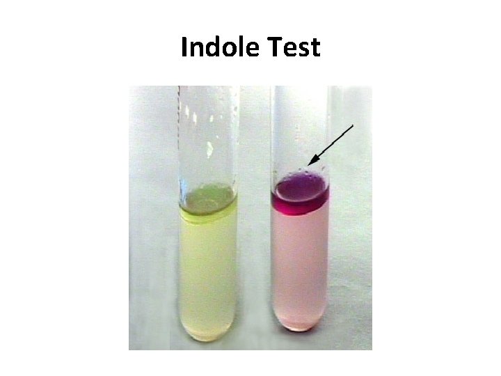 Indole Test 