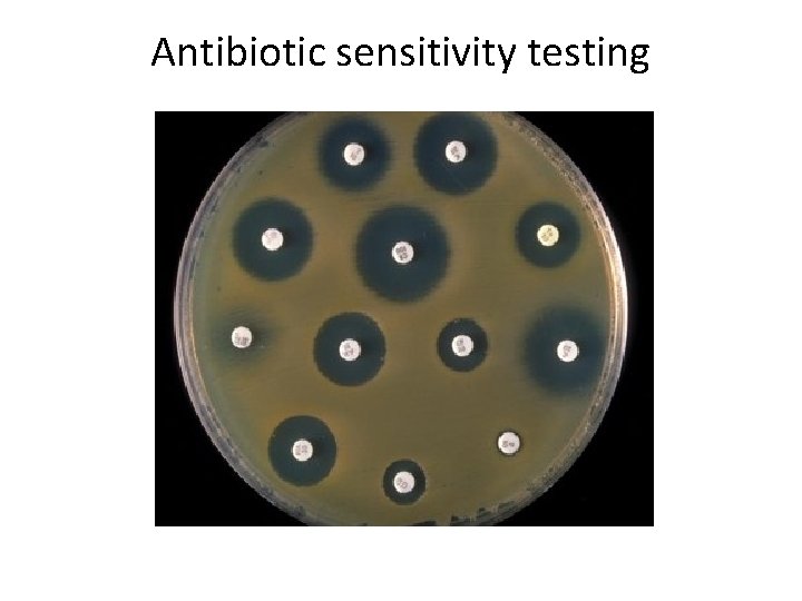 Antibiotic sensitivity testing 
