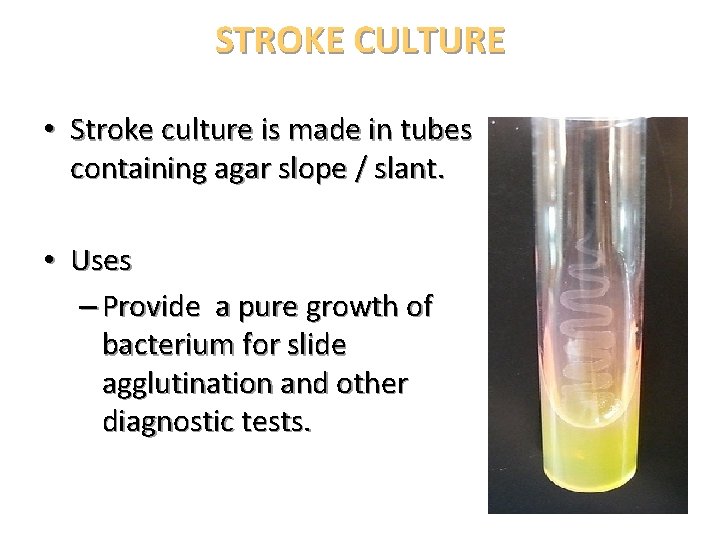 STROKE CULTURE • Stroke culture is made in tubes containing agar slope / slant.