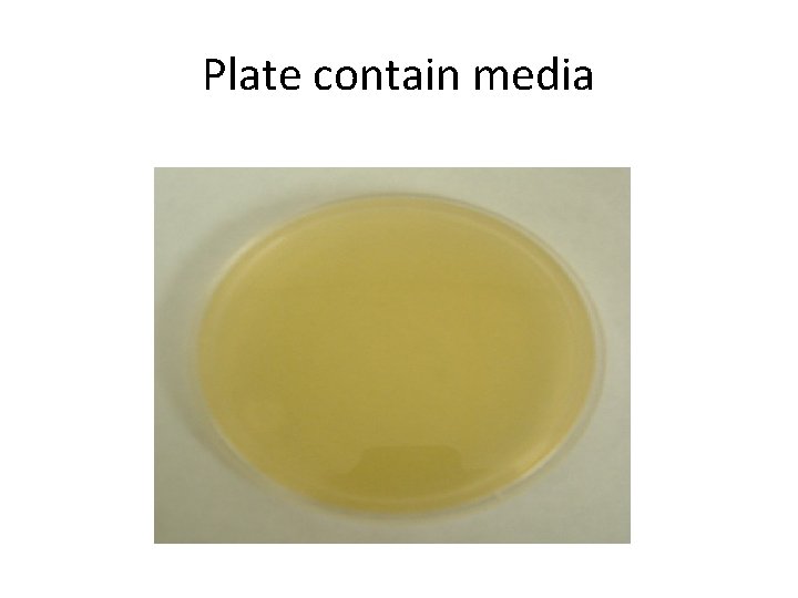 Plate contain media 
