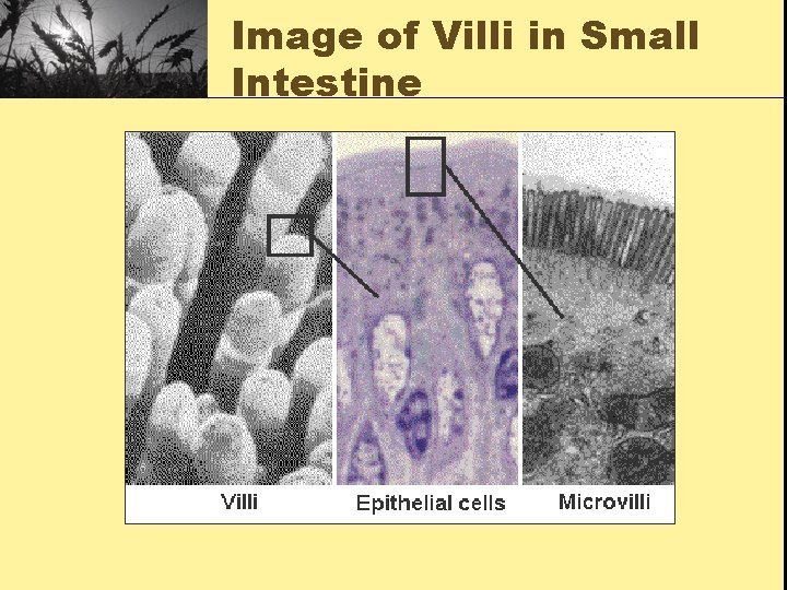 Image of Villi in Small Intestine 