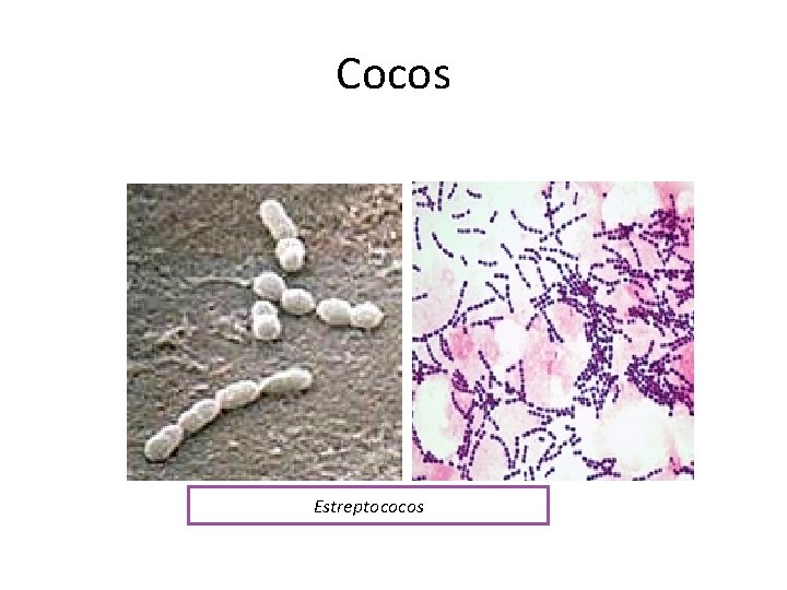 Cocos Estreptococos 