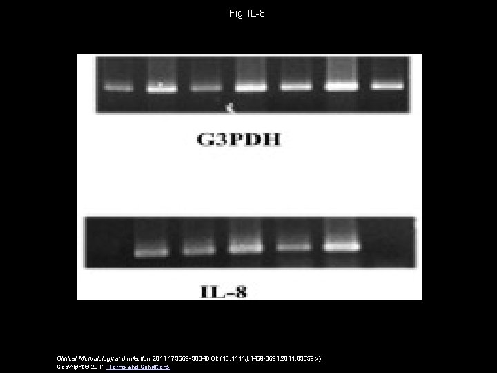 Fig: IL-8 Clinical Microbiology and Infection 2011 17 S 669 -S 834 DOI: (10.