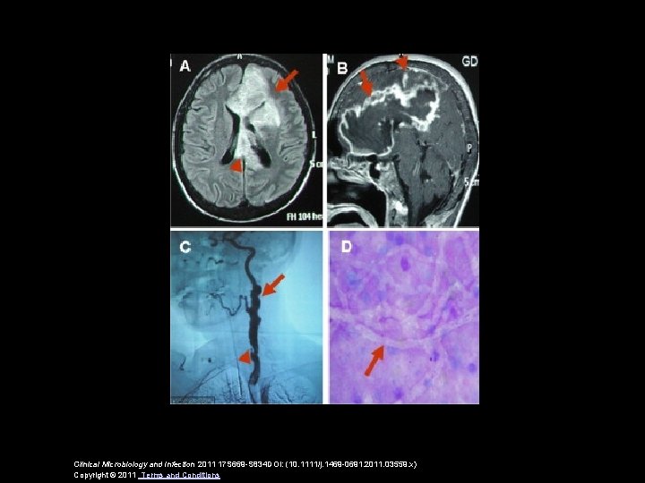 Clinical Microbiology and Infection 2011 17 S 669 -S 834 DOI: (10. 1111/j. 1469