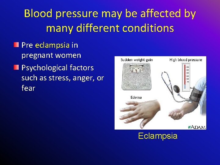 Blood pressure may be affected by many different conditions Pre eclampsia in pregnant women