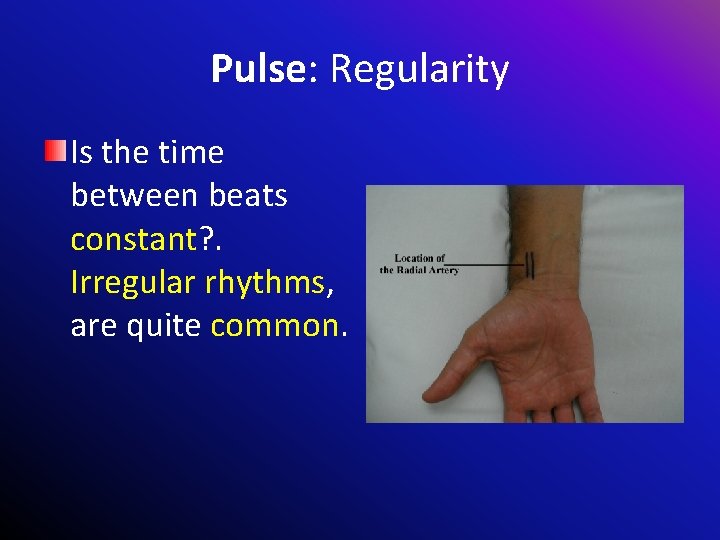 Pulse: Regularity Is the time between beats constant? . Irregular rhythms, are quite common.