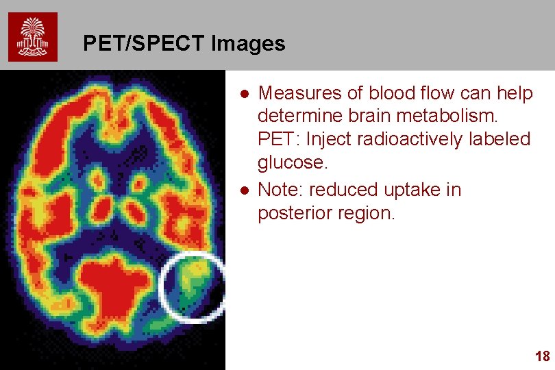 PET/SPECT Images l l Measures of blood flow can help determine brain metabolism. PET: