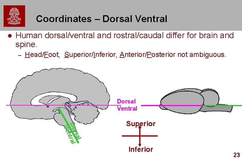 Coordinates – Dorsal Ventral l Human dorsal/ventral and rostral/caudal differ for brain and spine.