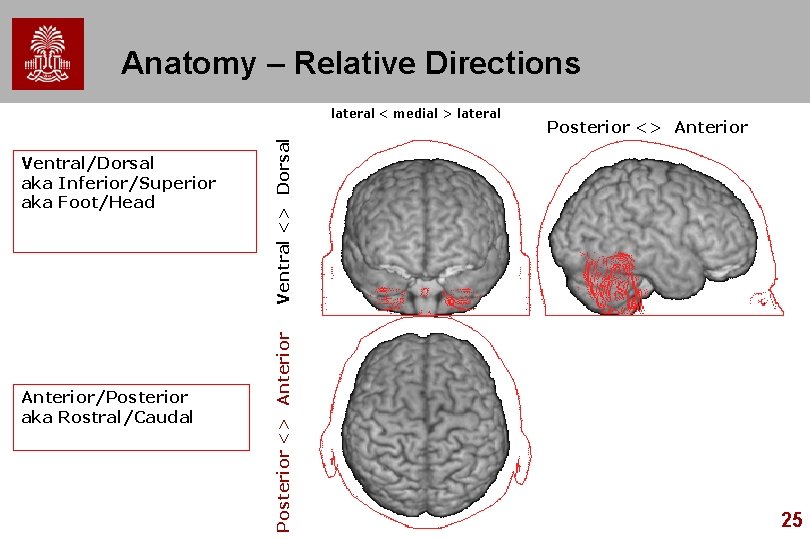 Anatomy – Relative Directions Anterior/Posterior aka Rostral/Caudal Posterior <> Anterior Ventral/Dorsal aka Inferior/Superior aka