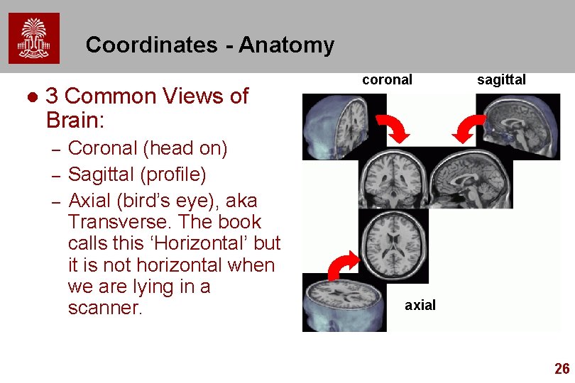 Coordinates - Anatomy l 3 Common Views of Brain: – – – Coronal (head