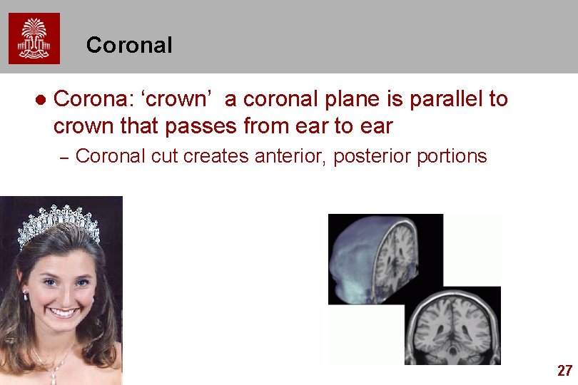 Coronal l Corona: ‘crown’ a coronal plane is parallel to crown that passes from