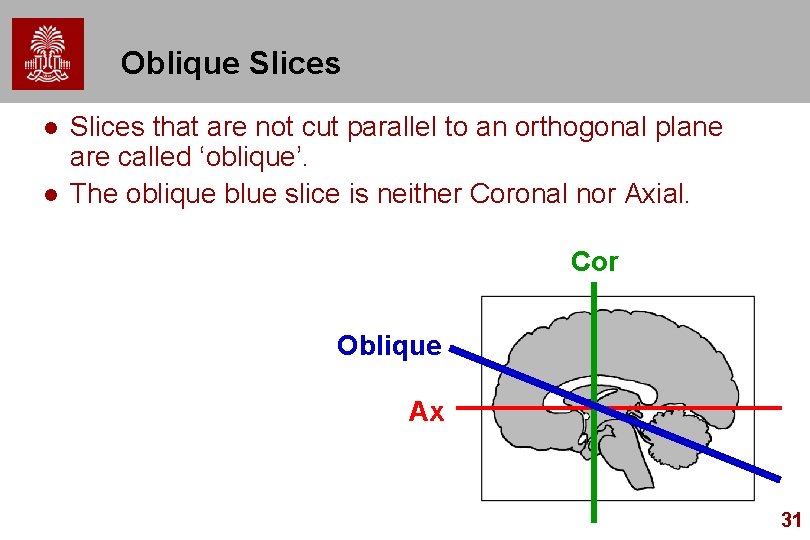 Oblique Slices l l Slices that are not cut parallel to an orthogonal plane