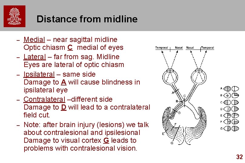 Distance from midline – – – Medial – near sagittal midline Optic chiasm C