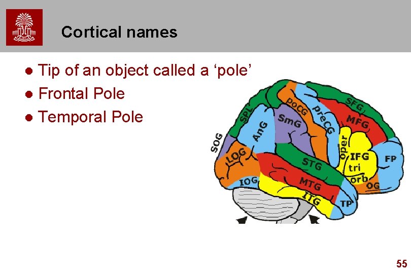 Cortical names Tip of an object called a ‘pole’ l Frontal Pole l Temporal