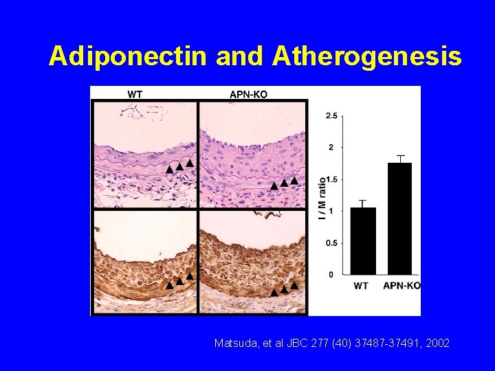 Adiponectin and Atherogenesis Matsuda, et al JBC 277 (40) 37487 -37491, 2002 Adiponectin and Atherogenesis Matsuda, et al JBC 277 (40) 37487 -37491, 2002