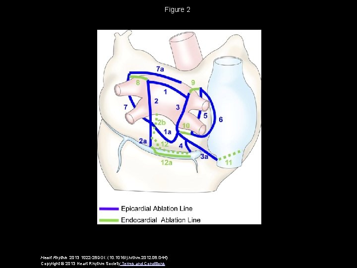 Figure 2 Heart Rhythm 2013 1022 -28 DOI: (10. 1016/j. hrthm. 2012. 08. 044)