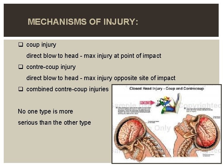  MECHANISMS OF INJURY: q coup injury direct blow to head - max injury