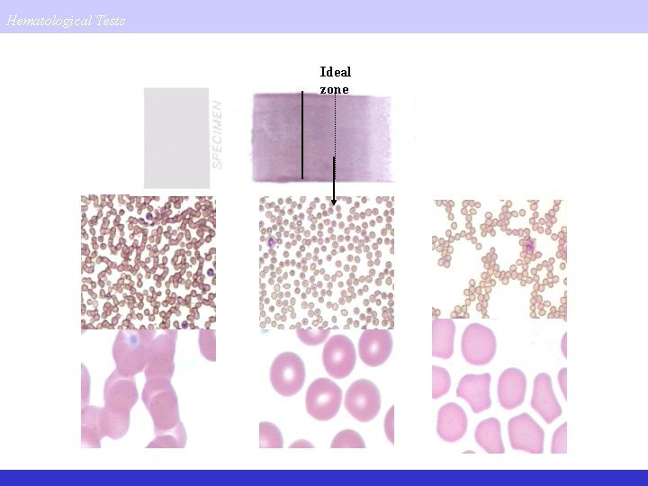 Hematological Tests Ideal zone 