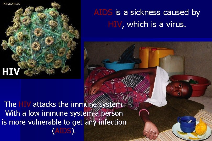 AIDS is a sickness caused by HIV, which is a virus. HIV The HIV
