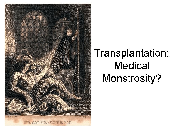 Transplantation: Medical Monstrosity? 
