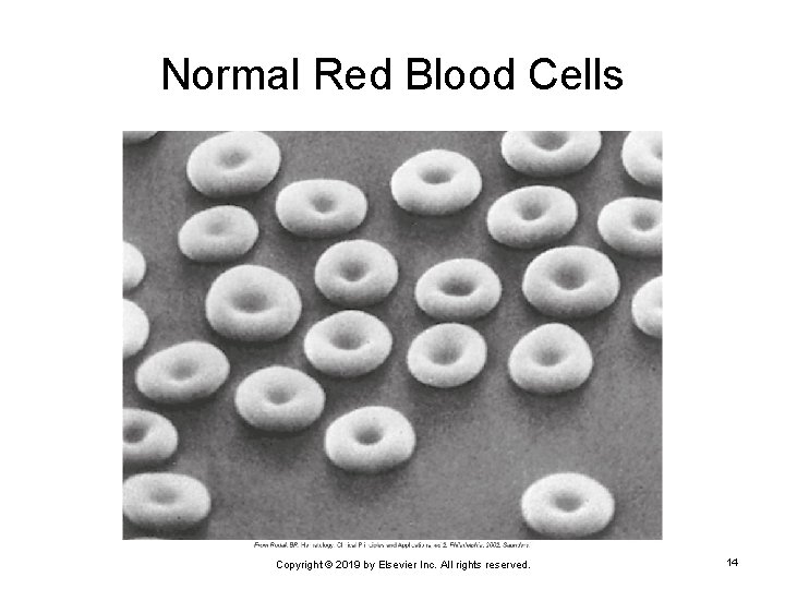 Normal Red Blood Cells Copyright © 2019 by Elsevier Inc. All rights reserved. 14