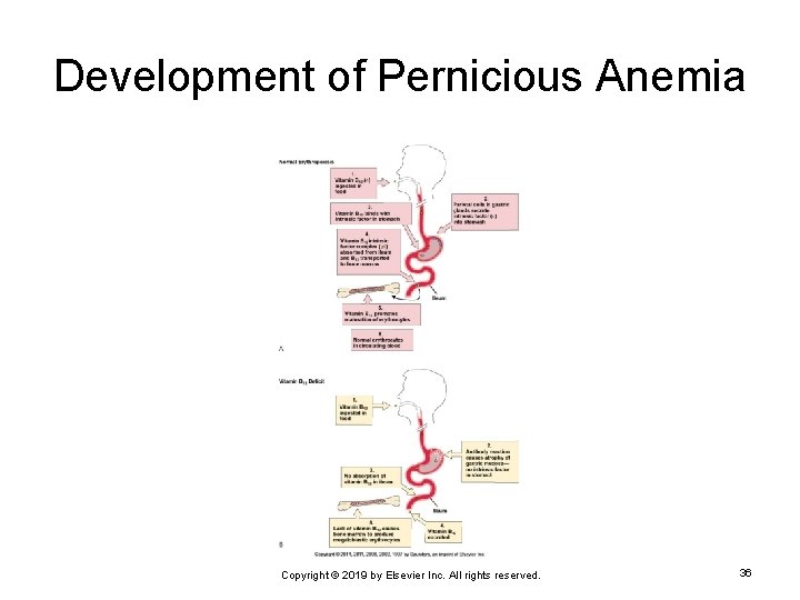 Development of Pernicious Anemia Copyright © 2019 by Elsevier Inc. All rights reserved. 36