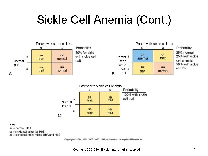 Sickle Cell Anemia (Cont. ) Copyright © 2019 by Elsevier Inc. All rights reserved.