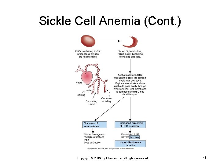 Sickle Cell Anemia (Cont. ) Copyright © 2019 by Elsevier Inc. All rights reserved.