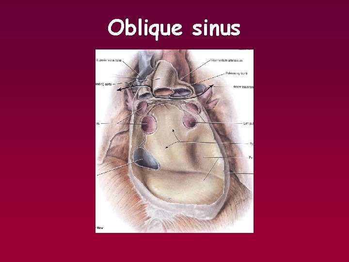 Oblique sinus 