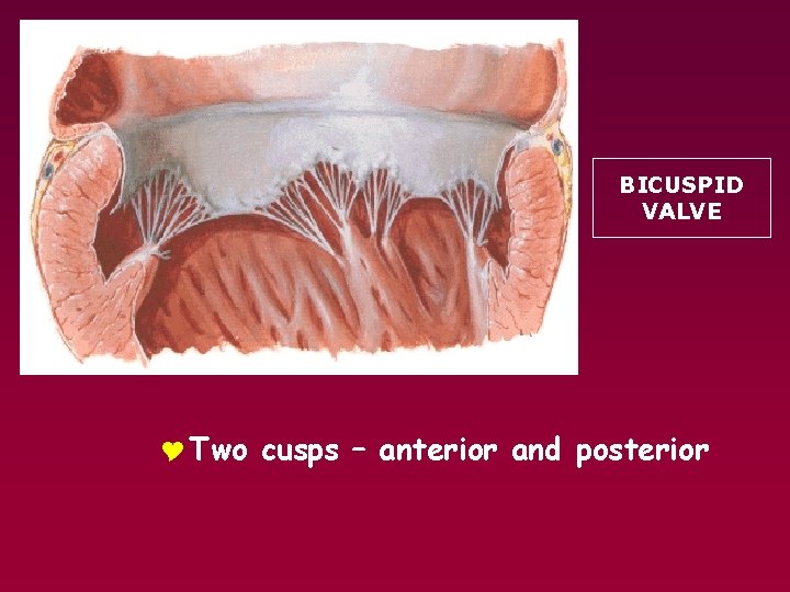 BICUSPID VALVE Y Two cusps – anterior and posterior 