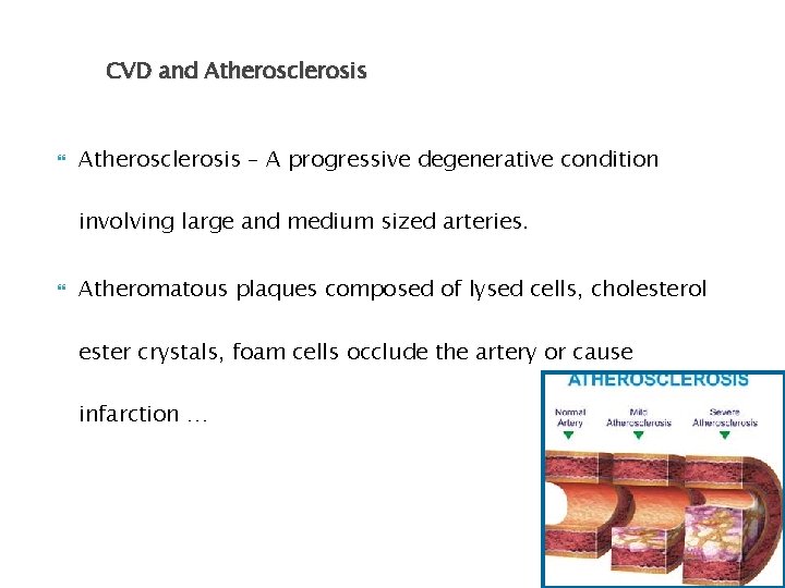 CVD and Atherosclerosis – A progressive degenerative condition involving large and medium sized arteries.