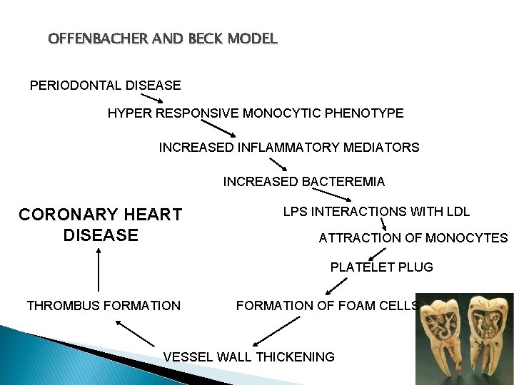 OFFENBACHER AND BECK MODEL PERIODONTAL DISEASE HYPER RESPONSIVE MONOCYTIC PHENOTYPE INCREASED INFLAMMATORY MEDIATORS INCREASED