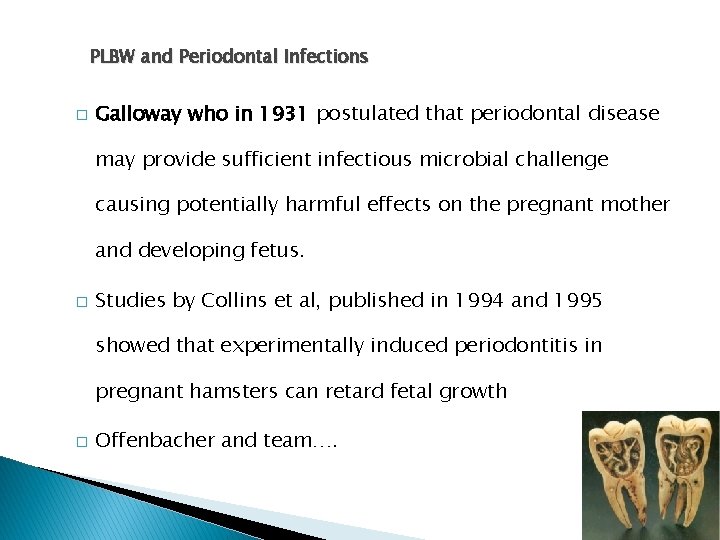 PLBW and Periodontal Infections � Galloway who in 1931 postulated that periodontal disease may