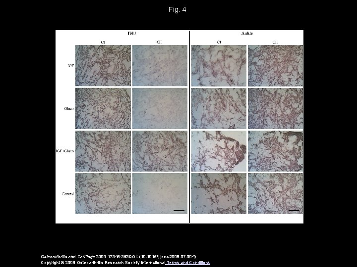 Fig. 4 Osteoarthritis and Cartilage 2009 17346 -353 DOI: (10. 1016/j. joca. 2008. 07.