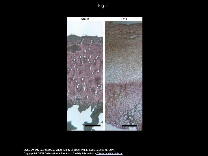 Fig. 5 Osteoarthritis and Cartilage 2009 17346 -353 DOI: (10. 1016/j. joca. 2008. 07.