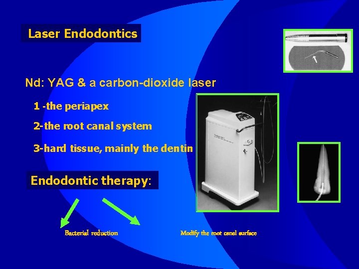 Laser Endodontics Nd: YAG & a carbon-dioxide laser 1 -the periapex 2 -the root